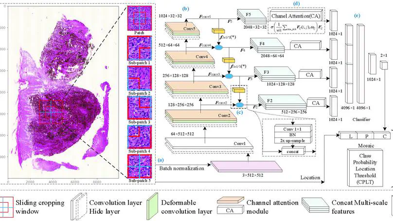 MPMR: multi-scale feature and probability map for melanoma recognition