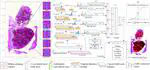 MPMR: multi-scale feature and probability map for melanoma recognition